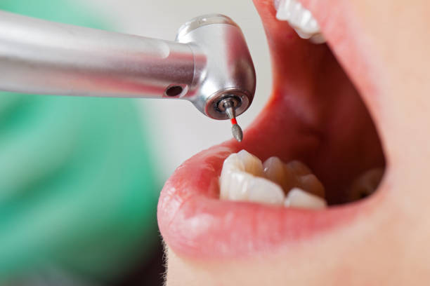 Best Broken Tooth Emergency  in Flourtown, PA